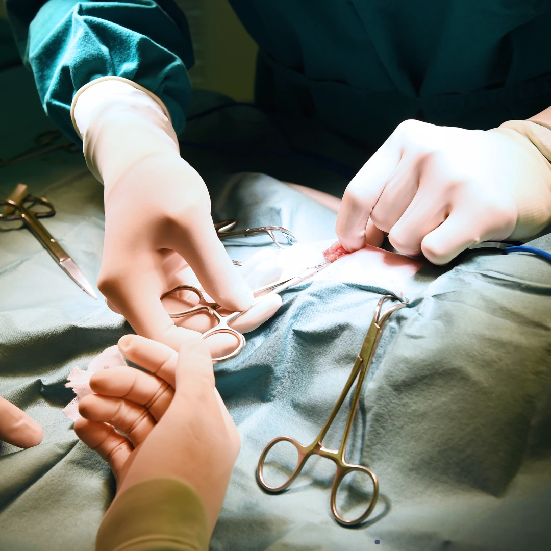 Failed back surgery syndrome