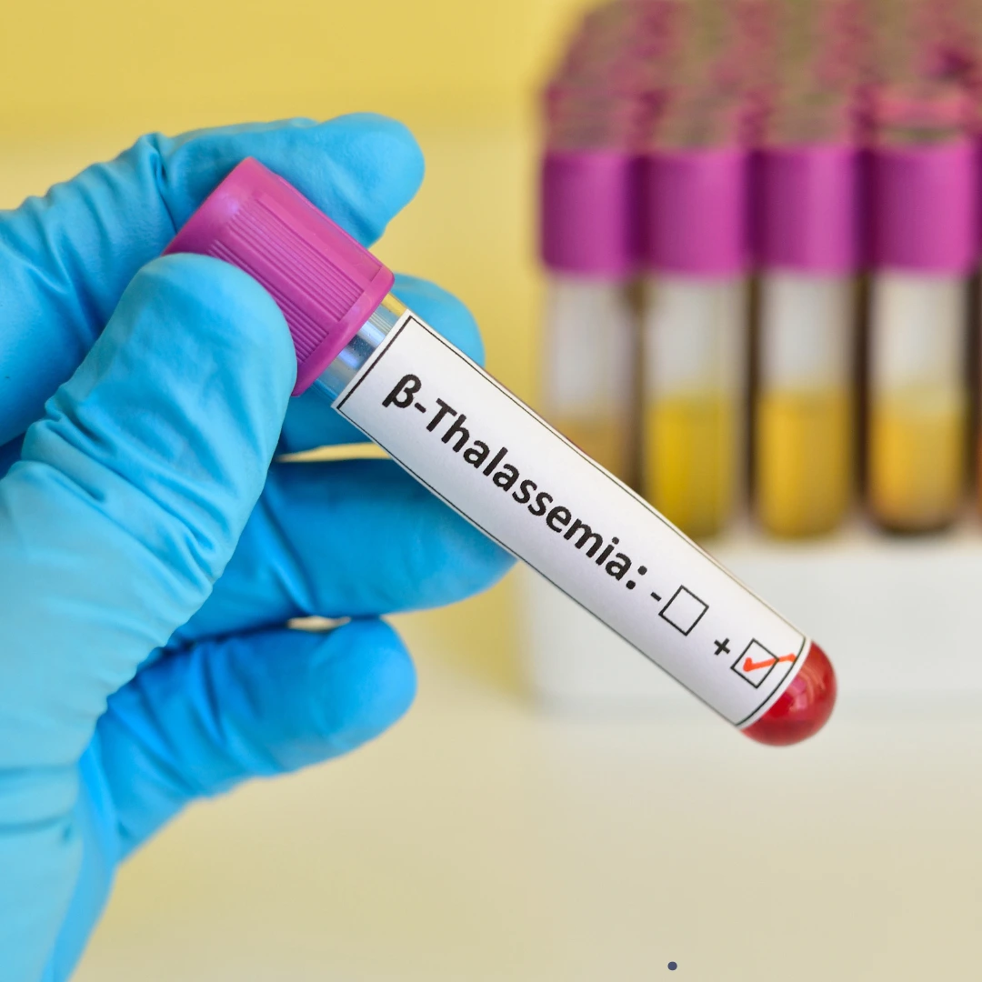 Thalesemia
